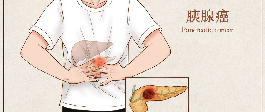 摄图网_401795368_wx_胰腺癌医疗插画（企业商用）.jpg